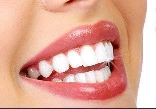 Miracle Brite Smile Mouthwash - Teeth whitening, Breath freshening, Removing Bad Breaths & Tooth Sensitivity with The Power of 3% Hydrogen Peroxide and Organic Essential Oils.