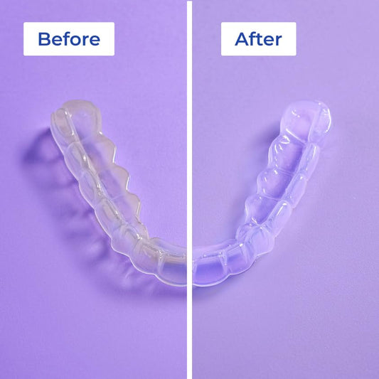 ALIGNER Cleaner Rinse | Concentrated | Clean aligners, retainers, dentures, Mouth Guards, Dental Appliance | 4 Month Supply, Alcohol Free, Minty & Fresh. Made in USA - Pack of 2 (33 fl.oz)