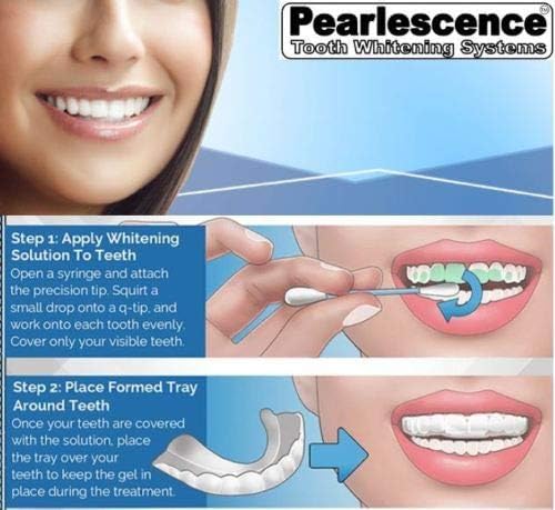 Pearlescence Teeth Whitening System 35% Carbamide Peroxide Gel Kit - 4 x 3cc / ml Mint Syringe Gel + 3 Boil and Bite Trays