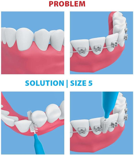 Piksters Interdental Brushes, 40 pk, Size 5, Interdental Tooth Brush for Large Gaps, Gum Soft Bristles for Plaque Removal, Safe for Braces