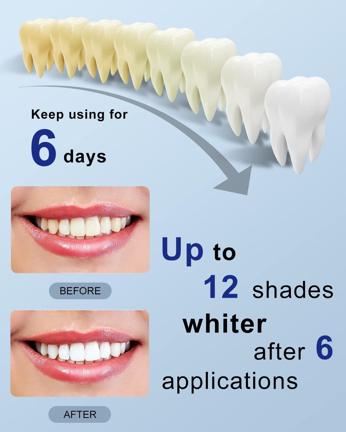 MySmile Teeth Whitening Strips Kit 14 Treatments with 28 LED Light - 10 Min Non-Sensitive Fast Whitening Teeth Enamel Safe Teeth Whitener - Helps to Remove Deep Stains