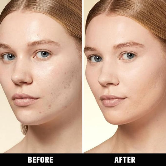 Kaely Liquid Concealer for Older Women, Under Eye Brightener Full Coverage Concealer for Dark Circles, Color Correcting Foundation Face Makeup Waterproof, Vegan & Cruelty-Free, 05 Medium