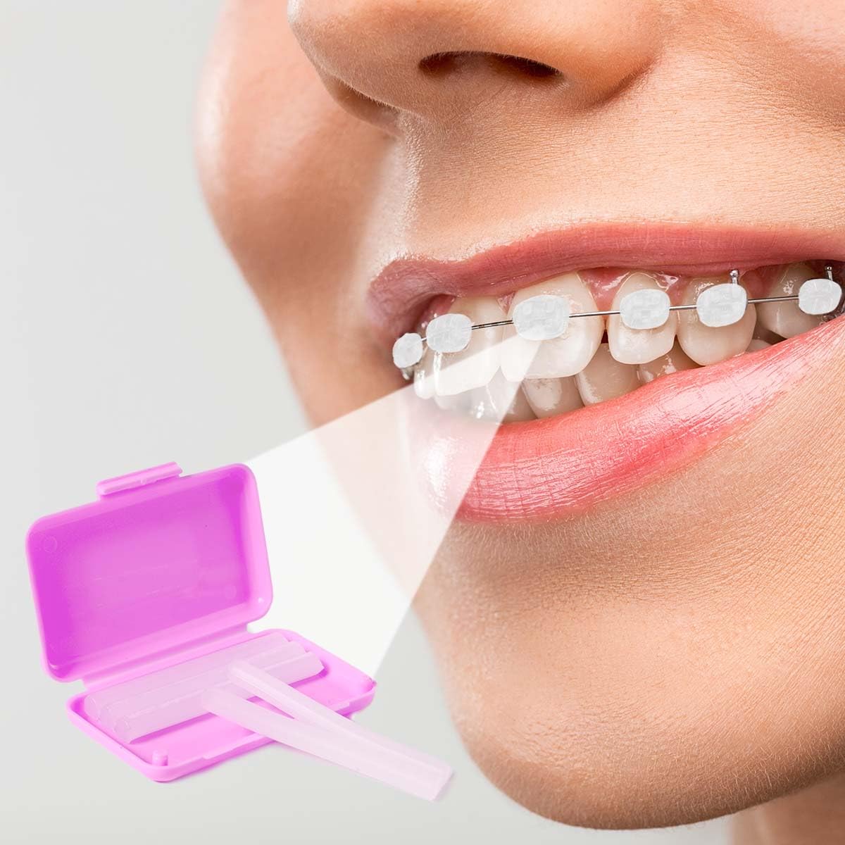 24 Pack Colorful Orthodontic Wax Dental Wax for Braces Wearer