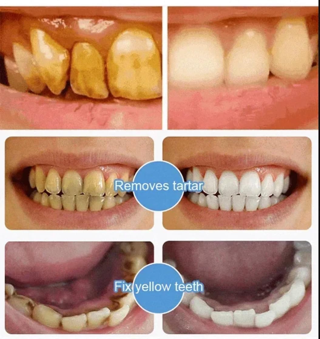 7.5 nHAP Hydroxyapatite Toothpaste - Nano Hydroxyapatite Whiteing Teeth | Enamel Repair | Fluoride-Free | Deep Cleaning Care Oral Health | Breath Freshening | Mild Mint | Sensitive Tooth (2)