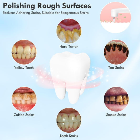 Tooth Polisher, Rechargeable Teeth Polisher for Daily Cleaning, Whitening and Polishing, Electric Dental Teeth Polishing with LED Light, 5 Brush Heads, 5 Speed Modes, Waterproof