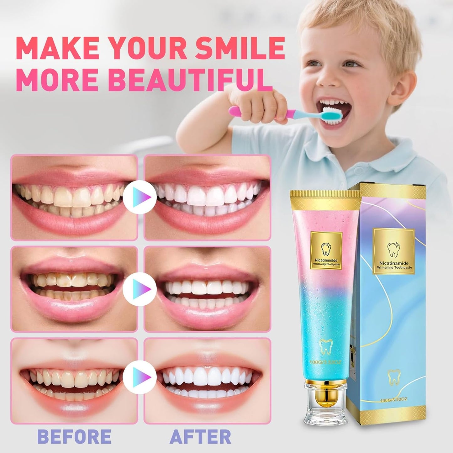 Niacinamide Whitening Toothpaste, Nicotinamide White Toothpaste, Clean The Mouth, Fresh Breath, Remove Tooth Stains, Teeth Whitening Toothpastes