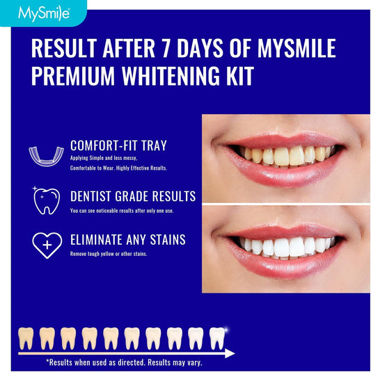 MySmile 7 Treatments Prefilled Teeth Whitening Trays Kit with 12% Hydrogen Peroxide Whiter Gel for Sensitive Tooth, Fast-Result Vegan Teeth Whitener Tooth Stain Remover, Mint Flavor