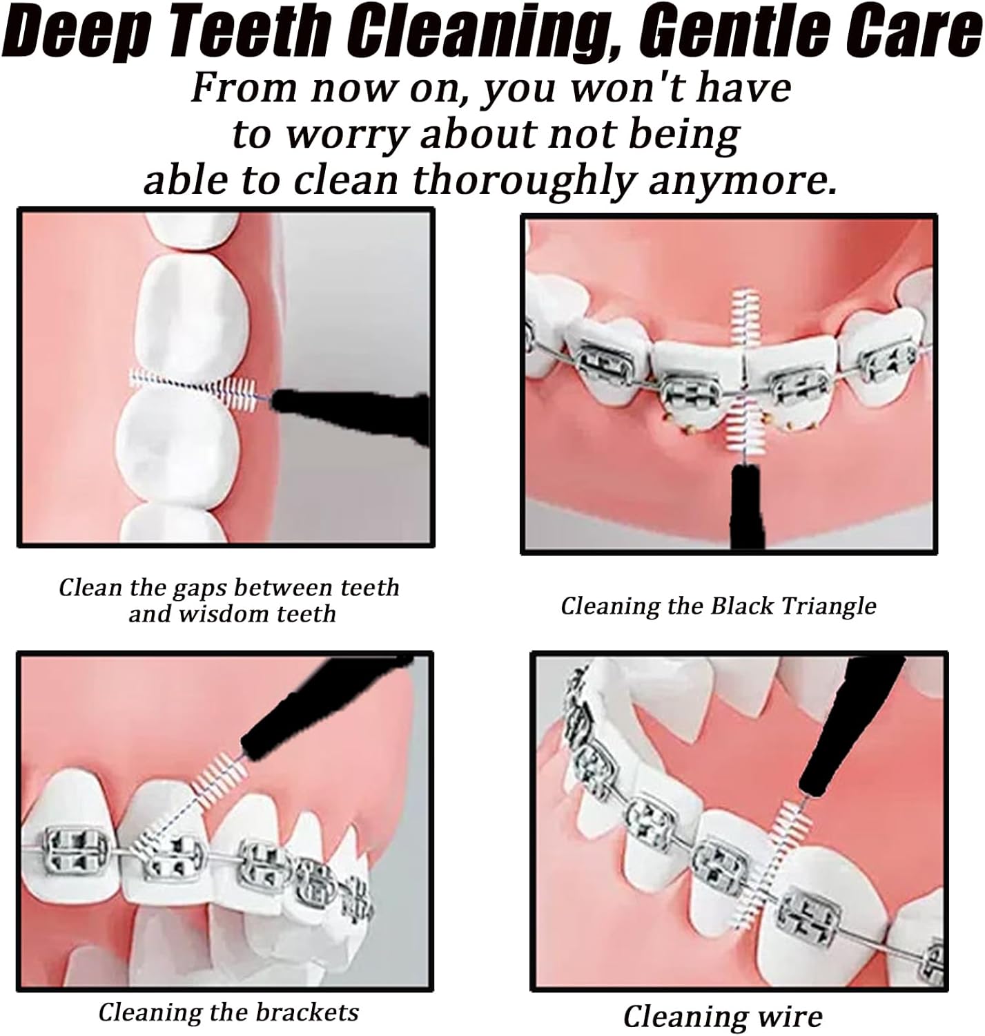130-Count Interdental Brushes Set - Black & White Orthodontic Cleaning Kit with Spiral Brush Heads, Braces-Friendly Flossers & Toothpicks for Efficient Teeth & Braces Care
