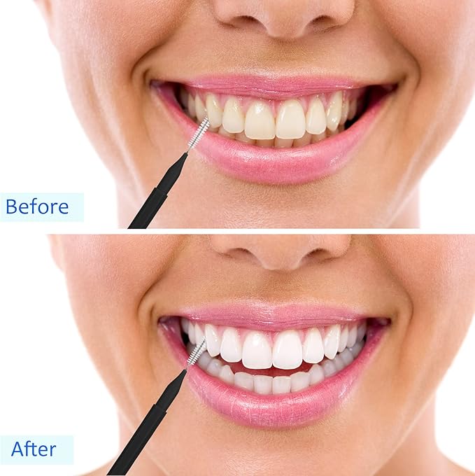 Patelai 100 Pieces Braces Brush for Cleaner Interdental Brush Toothpick Dental Tooth Flossing Head Oral Dental Hygiene Flosser Toothpick Cleaners Tooth Cleaning Tool (Black)