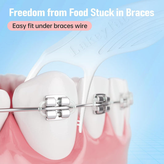 200 Count Twin-Line Braces Flossers, Orthodontic Flossers for Braces, Fits Under Arch Wire No Damage, Whale Wider Handle with Unique Finger Press, Ortho Dental Floss for Kids & Adults, Mint