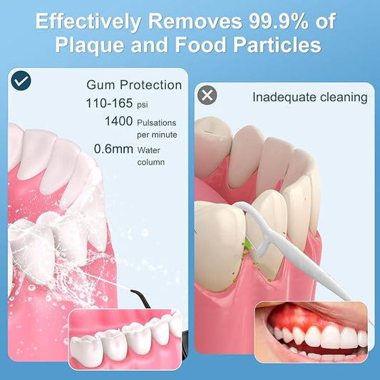 300mL Water Flosser Cordless - Rechargeable Travel Water Flossers for Teeth Cleaning with 5 Pressure Settings, 4 Tips, IPX7 Waterproof for Teeth Cleaning