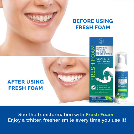 Aligner & Retainer Cleaner Fresh Foam – Dry Mouth Relief, Compatible with All Clear Aligners, Retainers, Mouth Guards, Night Guards, Veneers, Whitens, Freshens, 3% Hydrogen Peroxide, Mint - 50ml 3pcs