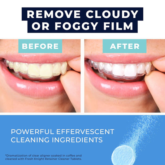Retainer Cleaner Tablets 120 - Invisalign Cleaner - Denture Cleaner. Efferdent Retainer Cleaner Tablets, Night Guard, Mouth Guards, Aligners & Dental Appliance Cleaner - 4 Month Supply.