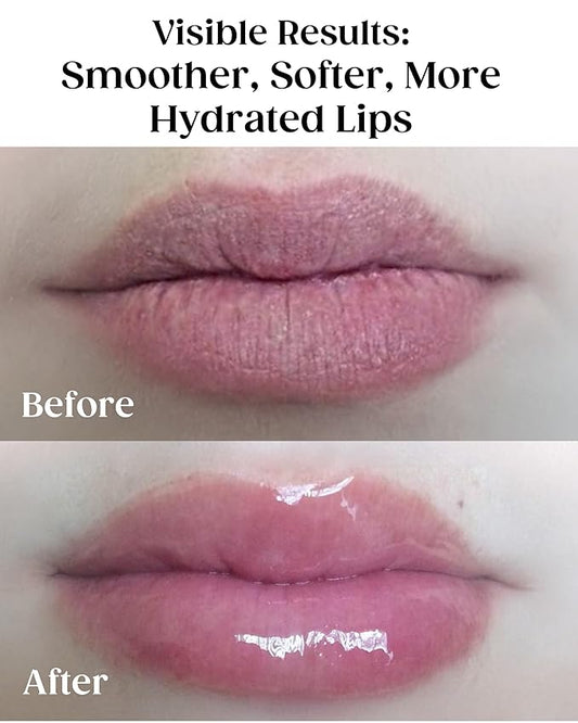 KAPLAN MD Perfect Pout Lip Mask & SPF 30 Lip Balm Duo – Hydrating Treatment with Hyaluronic Acid – Lip Mask (1 oz) + Rose Blush Balm (0.35 oz)