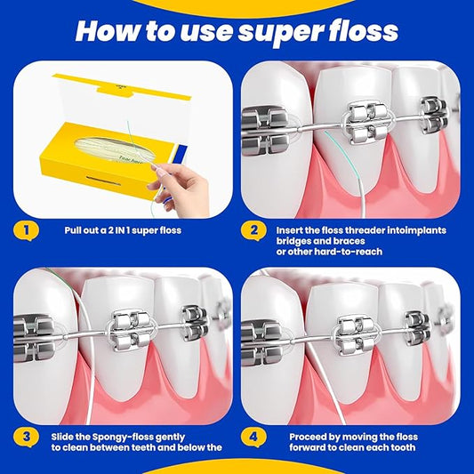 Dental Floss for Braces,Pre-Cut Strands Floss,Threaders for Bridges,Threaded Floss for Braces & Bridges,50 Counts