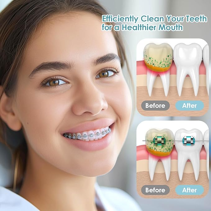 150Pcs Interdental Brushes & Floss Picks Kit, 100Pcs Dental Floss Picks & 50Pcs Braces Brush in 5Sizes, Bendable Braces Flossers Interdental Brushes Between Teeth Oral Tooth Braces Cleaner Kit