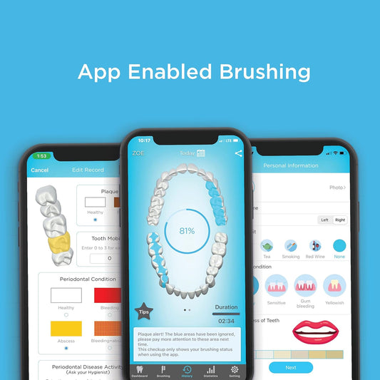 Blu Smart Bluetooth Enabled Kids Toothbrush with Live Tracking App to Teach Children Healthy Brushing Habits, Share Results with Your Dentist (Blue). Wireless Rechargeable Electric.