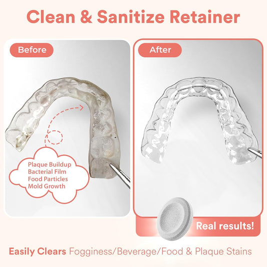 Weiss Naturals Retainer Cleaning Tablets, Invisalign Cleaner, Remove Stains, Odors & Plaque, FSA & HSA Eligible, Night Guard Cleaner PERSULFATE & DYE-FREE 2-Month Supply, Denture Cleaners, 60 Tablets