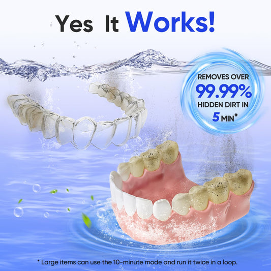 MySmile Ultrasonic Retainer Cleaner Machine with Tablets- 45kHz Black Dental Pod with 200ML Capacity and MySmile Retainer Cleaner with 120 Denture Cleaning Orange Flavor Tablets