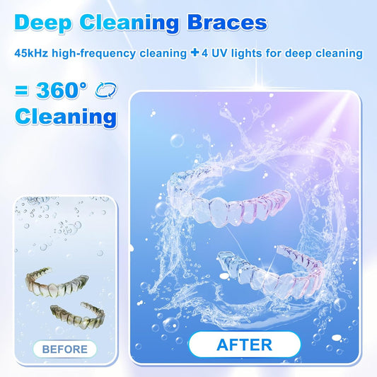 2025 Ultrasonic Retainer Cleaner, 4 UV Lights, 45kHz Deep Clean, Retainer Cleaner Machine for Dentures, Anti Grinding Mouth Guard, Braces, Toothbrush Heads, Toothbrush