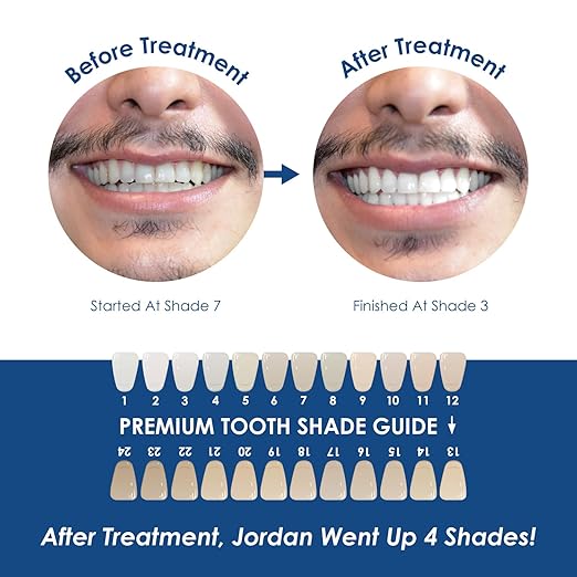 Deluxe Teeth Whitening Syringe Refill to Eliminate Teeth Discoloration While Fighting Plaque Bacteria, Teeth Whitening Set for A Stronger Enamel