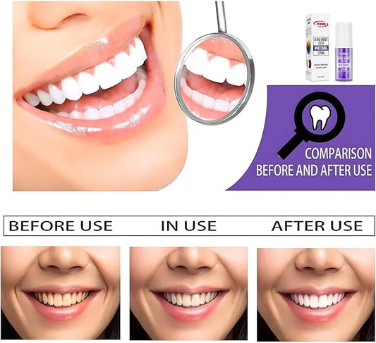 Purple Toothpaste Teeth Whitening Gel – Color Corrector Toothpaste for Yellow Teeth Removal – Peroxide-Free, Gentle Whitening Serum for Sensitive Teeth & Fresh Breath – 30ml by ITZZO
