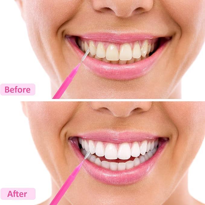 Patelai 100 Pieces Braces Brush for Cleaner Interdental Brush Toothpick Dental Tooth Flossing Head Oral Dental Hygiene Flosser Toothpick Cleaners Tooth Cleaning Tool(Bright Colors,Multiple Sizes)