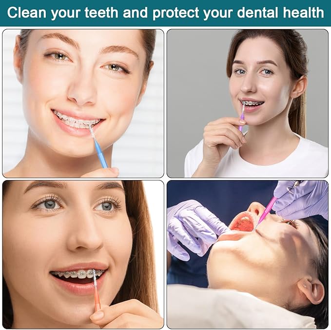 120 Pcs Interdental Brush + 25 Pcs Lip Wands Applicators Disposable, Braces Brush for Cleaner Interdental Brush Toothpick Dental Flossing Oral Dental Hygiene Flosser Tooth Cleaning Tools, Multicolor