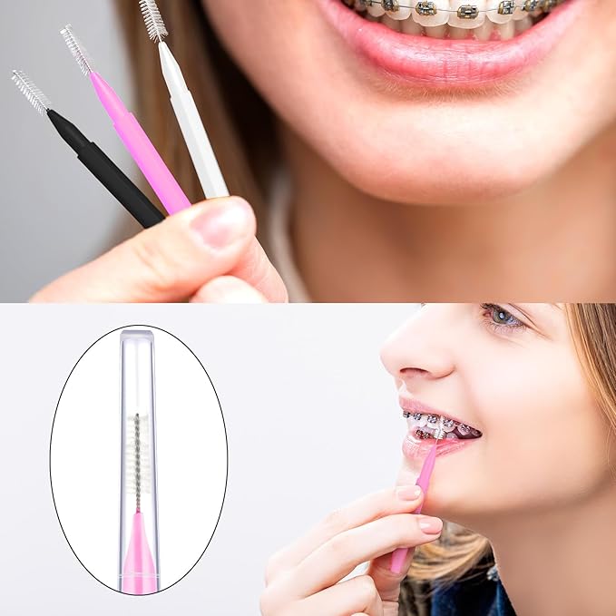 Patelai 100 Pieces Braces Brush for Cleaner Interdental Brush Toothpick Dental Tooth Flossing Head Oral Dental Hygiene Flosser Toothpick Cleaners Tooth Cleaning Tool(White, Black, Pink,Proper Size)