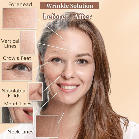 1 Roll Instant Face Lift Tape, Facial Myofascial Patch for Wrinkles Treatment Sticker for V Line Lifting Sagging Skin, Forehead Fines, Eyelid, Nasolabial Folds, Laugh Neck Lines (2cm*5m)