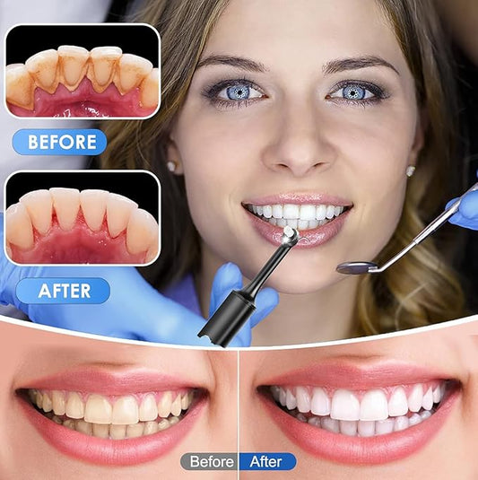 Tooth Polisher,Teeth whitening kit 12 Pieces Accessories,Teeth Polishing Kit for Daily Cleaning,Polishing Then Whitening kit