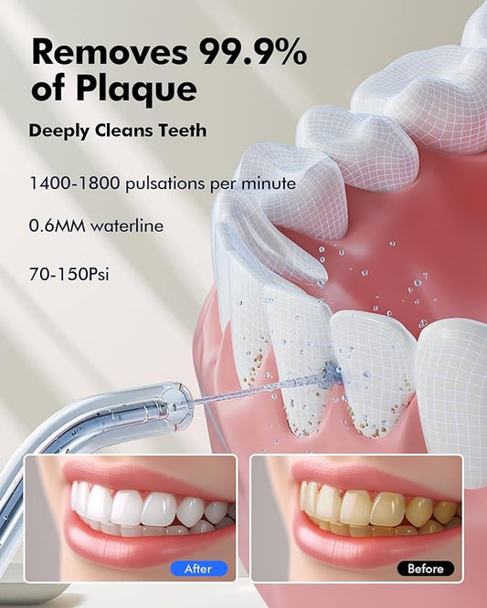 Water Flosser Teeth Pick: LED Display 5 Modes Cordless Dental Pick with 300ML Tank for Braces,Gums Care, IPX7 Waterpoof, 6 Jet Tips Water Flossing Cleaning Picks, Portable for Travel, Home, Y215 White