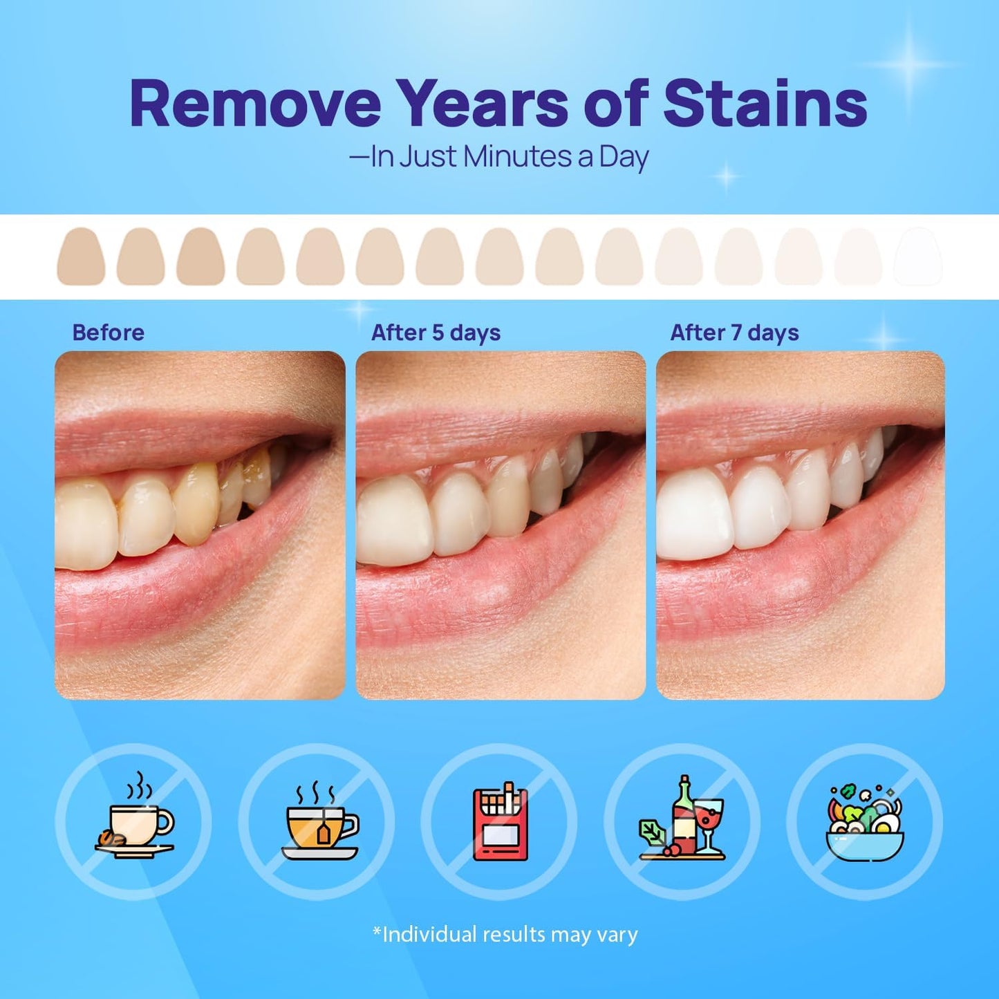 Whitebite Pro Upgraded Teeth Whitening Strips 14 Strips (7 Treatments) | Enamel-Safe | Deep Stains Removal | Non-Slip Design | Whitening Without Any Harm | Mint