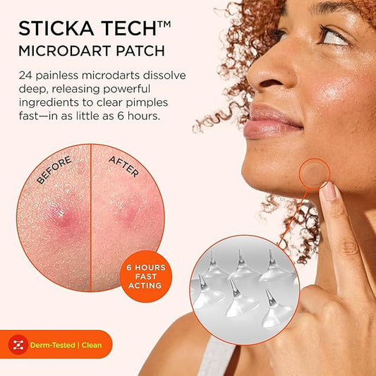 ZitSticka Killa Pimple Patches for Face - World's Most Potent Pimple Patch with Fast-Acting Microdarts - Starts Working within 26 Hours for Deep, Early-Stage Zits - Mini 24 Count