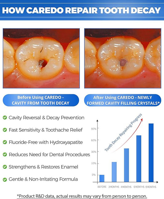 Cavity Reversal Hydroxyapatite Toothpaste for Adults, Cavity Tooth Filler as Home Cavity Repair, Fluoride Free Reverse Cavities Treatment for Tooth Decay Repair, Remineralizing Repair 3.52OZ