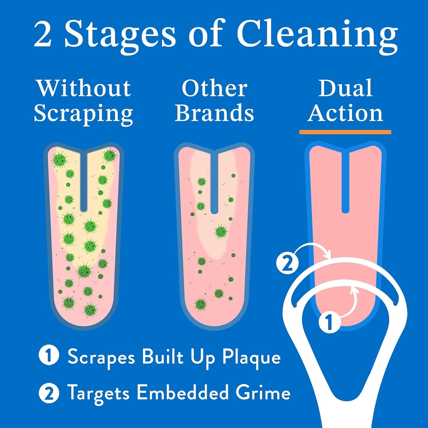 Mouthology Metal Tongue Scraper, Reduce Bad Breath in Seconds, Stainless Steel Tongue Cleaners for Adults, Metal Tounge Scrubber, Tongue Scraper Cleaner for Fresh Breath Tongue Brush (One Pack)