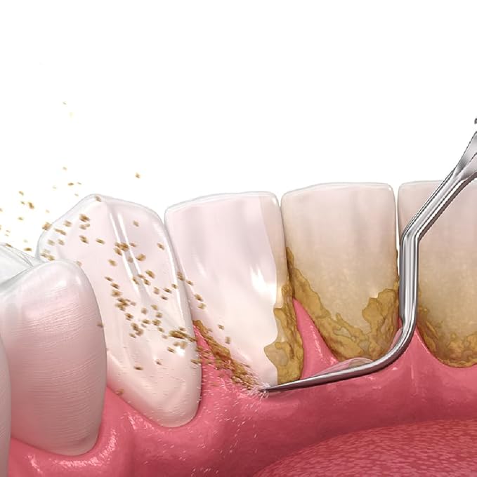 Stainless Steel Dental Kit - 6 Pack Dental Tools with Tooth Mirror, Dental Hygiene Kit for Adults, Kids, Dogs with Mirror, Picks, Travel Case (S)