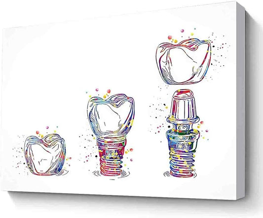 MBARE Watercolor Paintings Wall Decor,Dental Implant Art Watercolor Print Tooth Dental Clinic Decor Dentistry Student Science Dentist Gift Doctor~-8"X12" Canvas Print With Frame
