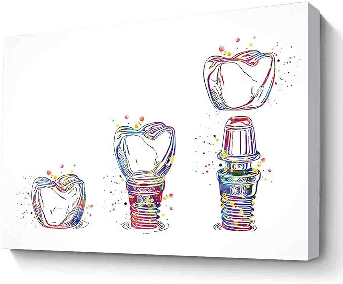 Framed Watercolor Painting,Dental Implant Art Watercolor Print Tooth Dental Clinic Decor Dentistry Student Science Dentist Gift Doctor~-12"X16" Canvas Print With Frame
