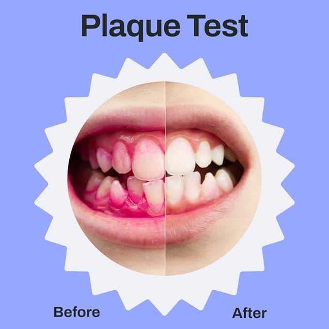 autobrush Kids Electric Toothbrush – Only ADA Accepted U-Shaped Toothbrush, Clinically Proven Up to 5.1X Better Cleaning, 30 Seconds, Full-Mouth 360 Coverage, LED Lights, Music, Age 9-12, Daniel Tiger