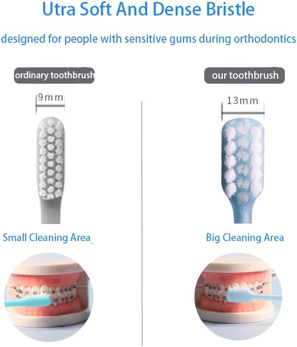 V-Shaped Orthodontic Toothbrush Dental Brush for Braces, for Kids/Teens/Adult, for Sensitive Teeth, for Delicate Gums, Soft Bristles, Toothbrush for Braces, with Tongue Cleaner, Blue, 3pcs