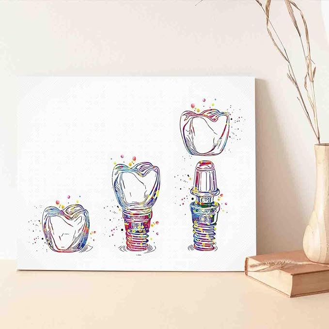 MBARE French Watercolor Paints,Dental Implant Art Watercolor Print Tooth Dental Clinic Decor Dentistry Student Science Dentist Gift Doctor~-16"X24" Canvas Print With Frame