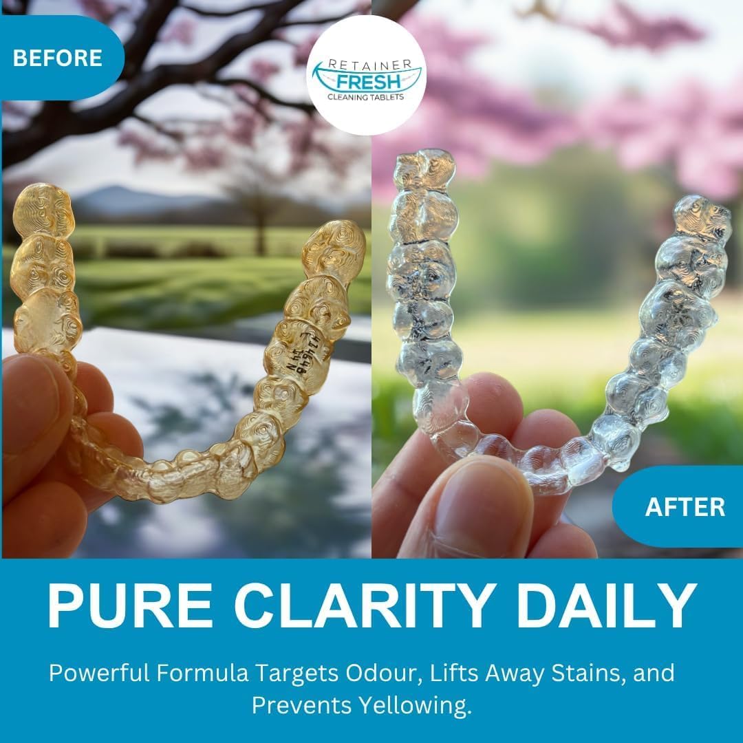 Retainer Cleaner Tablets - 36 Tablets 1 Month Retainer Fresh - Retainer Cleaning Tablets, Mouth Guard Cleaner, Denture Cleaner, Aligner Cleaner, Brite Retainer Tablets