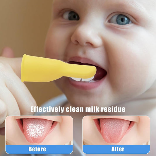Socub Baby Finger Toothbrush, 2Pcs Upgraded First Finger Toothbrush for Infants & Toddlers, Training Toddler Tooth Brush for Gentle Oral Care, Cleans All Sides at Once, BPA Free, 3Month+