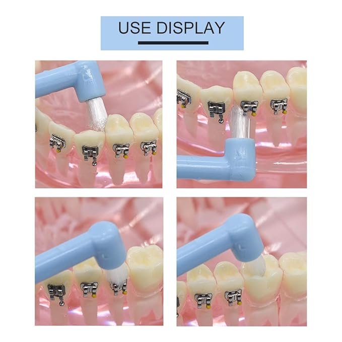 Angzhili 9-Piece Interspace Toothbrush Set - Tapered Orthodontic Brushes for Hard-to-Reach Areas, Gap Toothbrush for Braces, Bridges & Implants