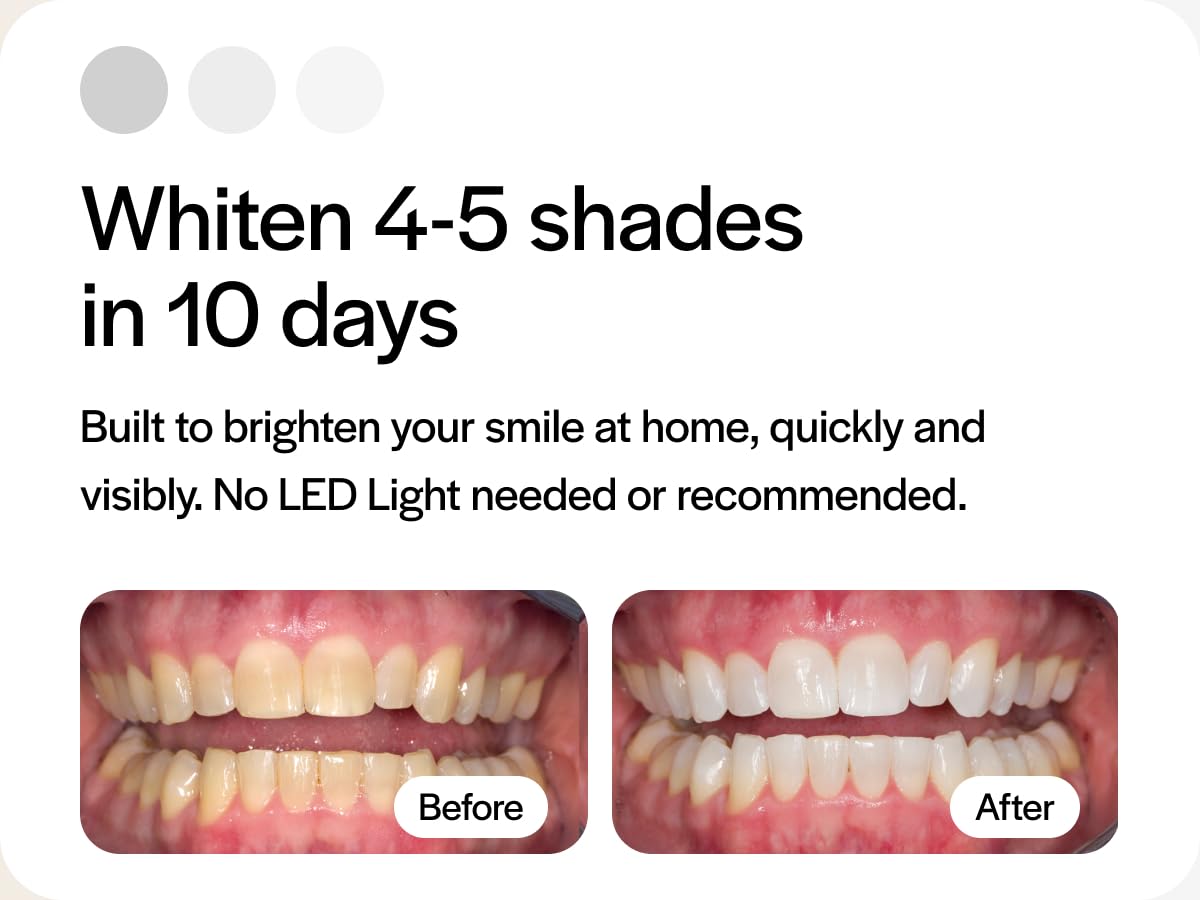 Opalescence 10% Teeth Whitening Kit - Gel Syringes Refills - Low Sensitivy (12 Units) - Fluoride, Carbamide Peroxide - Made in The USA by Ultradent 5211-6