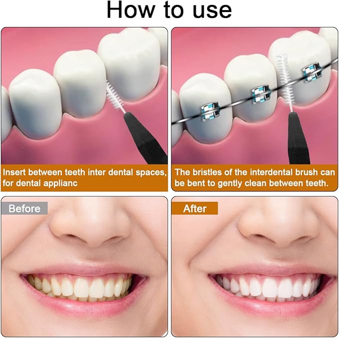 120 Pcs Interdental Brush + 25 Pcs Lip Wands Applicators Disposable, Braces Brush for Cleaner Interdental Brush Toothpick Dental Flossing Head Oral Dental Hygiene Flosser Tooth Cleaning Tools, Black