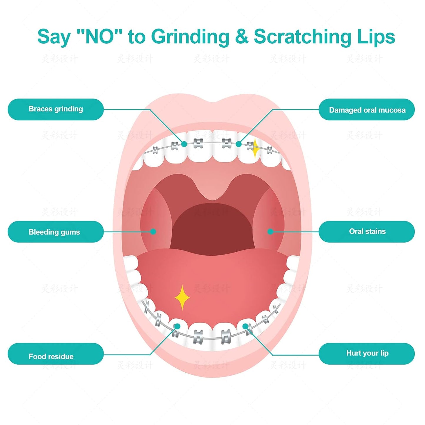 Annhua Braces Wax for Brackets Extra Soft 10 Pack, Dental Orthodontic Ortho Wax Strips with Cutter and Case for Braces Wearer and Aligners, 10 Fruit Smell