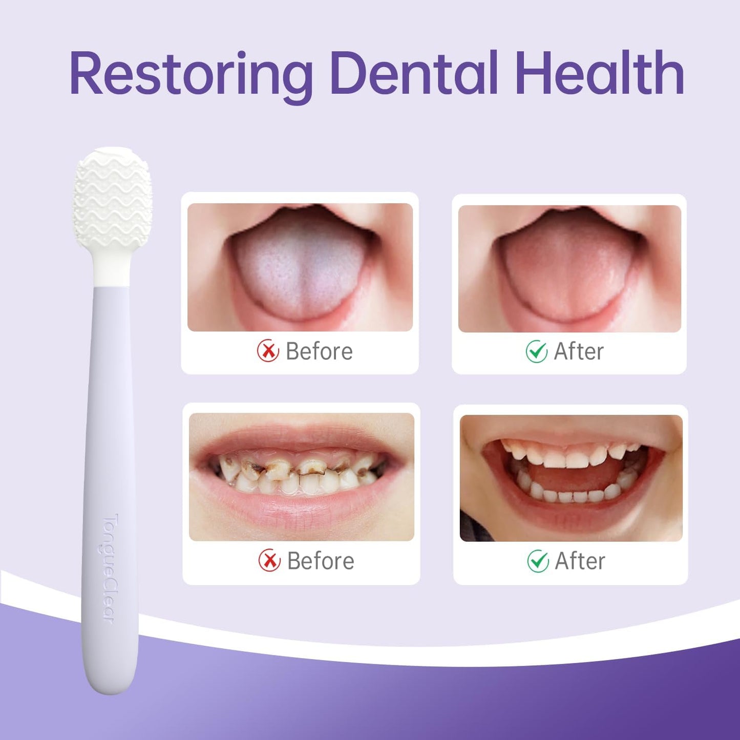 Kids Tongue Scraper, Tongue Cleaner for Infant & Newborn, Baby Oral Cleaner Newborn, Toddler Toothbrush for Tooth Mouth Gum Clean, Infant Toothbrush Oral Cleaning Stick…