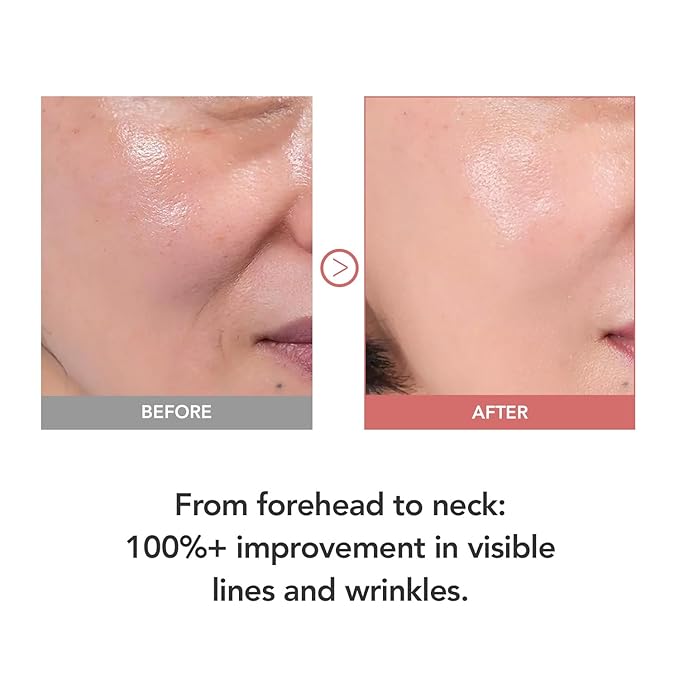 107% Crow’s Feet Improvement, 117% on Neck Lines & 109% on Nasolabial Lines – Boosts Elasticity – With Botulinum-Inspired Peptide and Collagen – Korean Skincare Korea’s Best Skincare Stick Kioskin